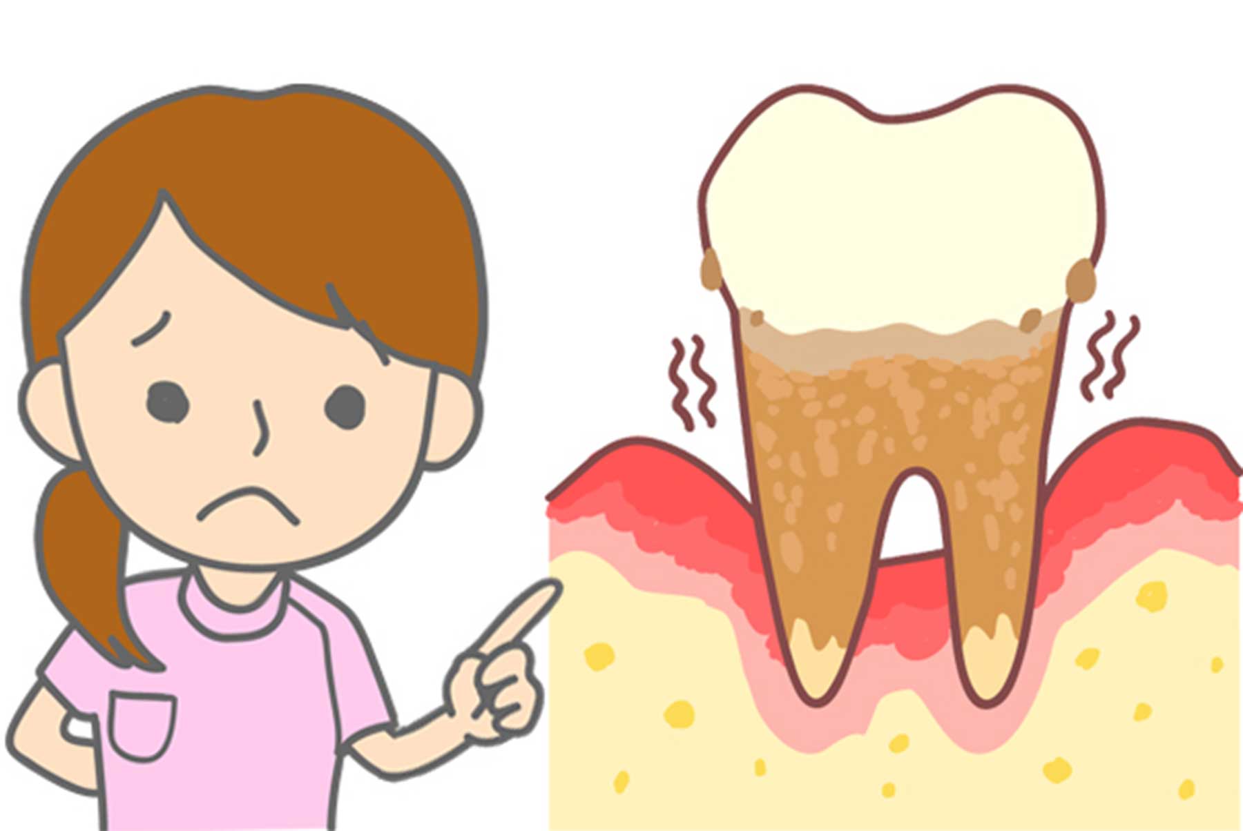 歯周病ってどんな病気？